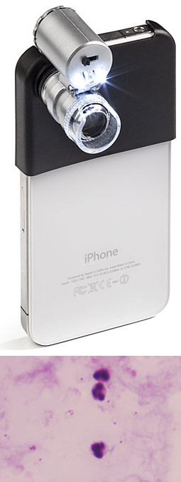 iPhone microscope